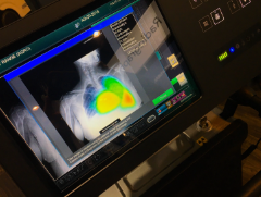 X-ray imaging technology